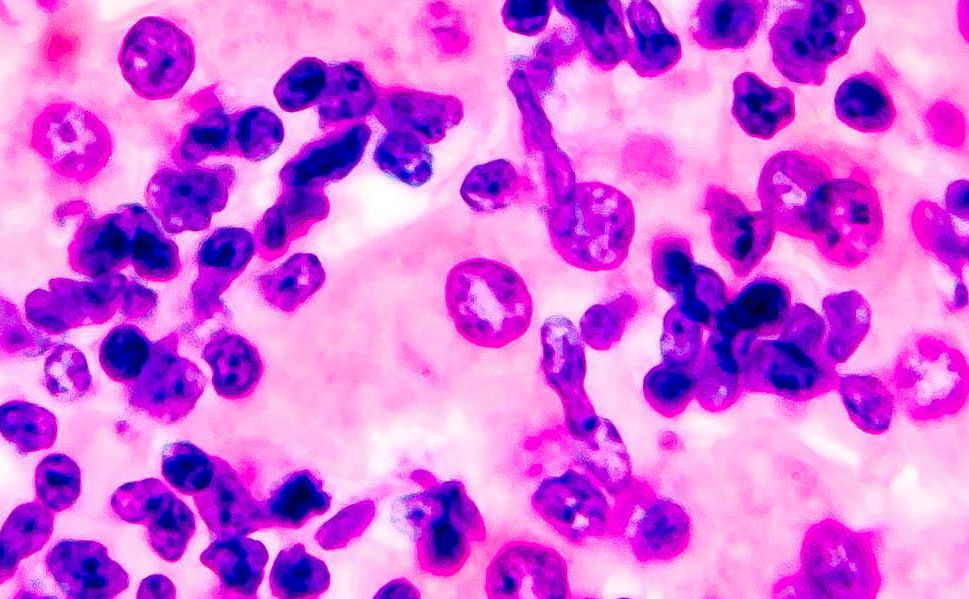 csm_Coccidiosis_coccidiainliver_b71e55e163