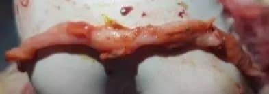 Practical_overview_on_mycotoxin