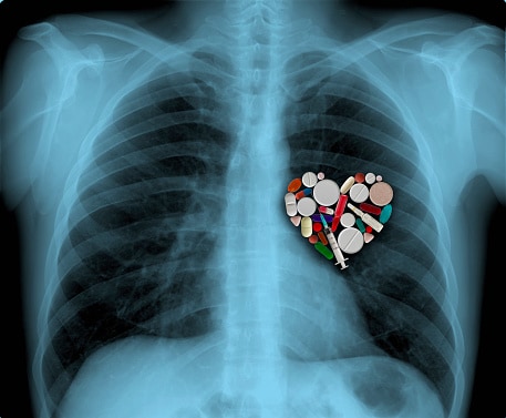Take it to Heart: Exploring the Role of High-Dose B-Vitamin Therapy in CVD Risk Reduction