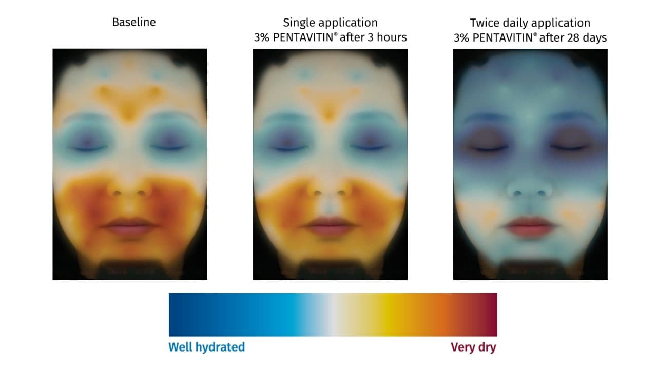Hydration measurement on facial skin with color mapping technology of skincare moisturizing ingredient PENTAVITIN®  