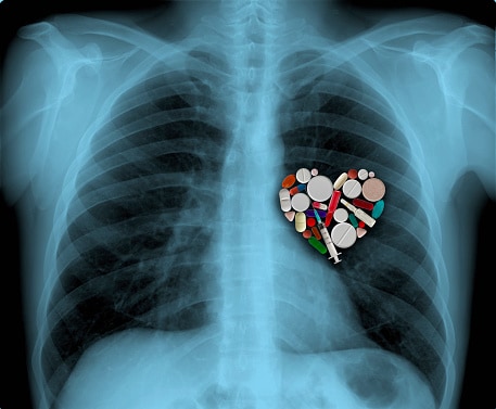 X-ray and medicine heart